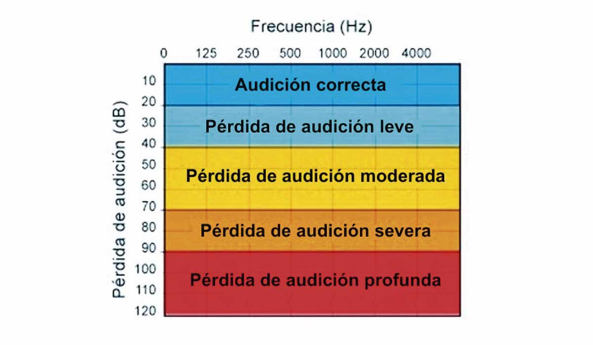 Grados de pérdida auditiva
