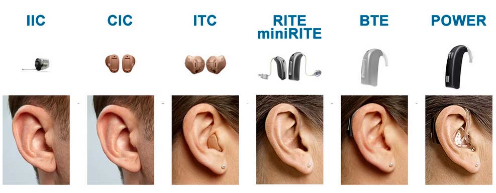 tipos audifonos